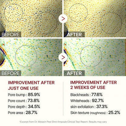 Dr.Melaxin Peel Shot Glow Rice Ampoule